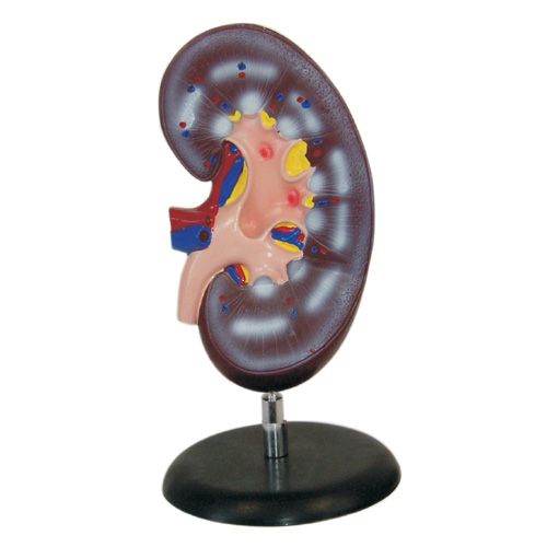 2배큰신장모형 XC-310-1