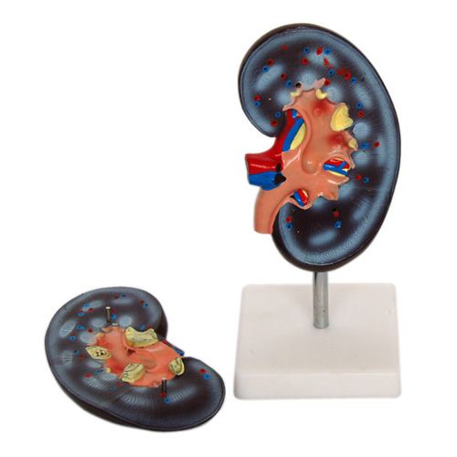 2배큰2파트신장모형 XC-310-2