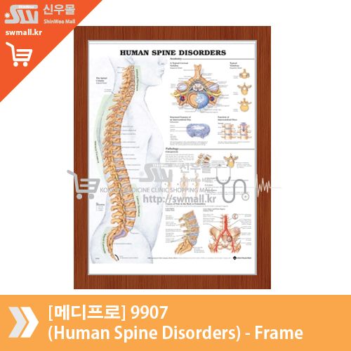 [메디프로]9970(The Human Spine-Disorders)